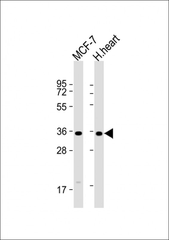 GPD1L Antibody (N-term)