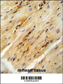 GPD1L Antibody (N-term)