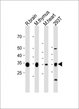 GPD1L Antibody (N-term)