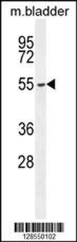 FBXW8 Antibody (Center)
