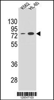 ENTPD3 Antibody (C-term)
