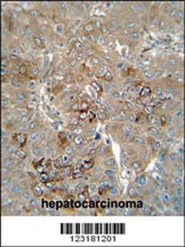 CES4 Antibody (N-term)