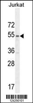 MPP1 Antibody (Center)