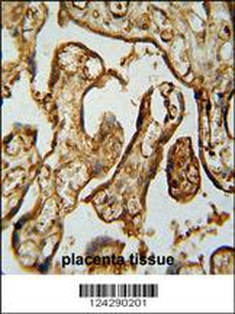MPP1 Antibody (Center)