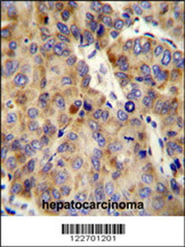 COL18A1 Antibody (Center)