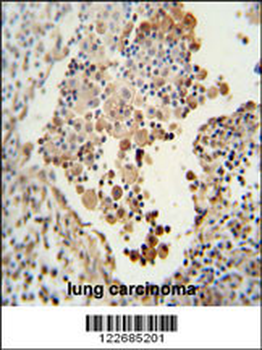CADM1 Antibody (N-term)