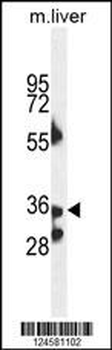 B3GNT4 Antibody (Center)