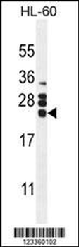 CSF2 Antibody (Center)