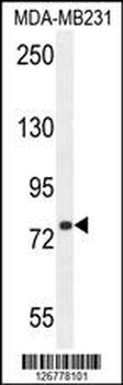 SORBS1 Antibody (Center)
