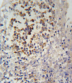 IL12_2 Antibody (C-term)