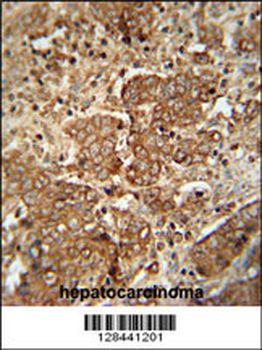 APCS Antibody (C-term)