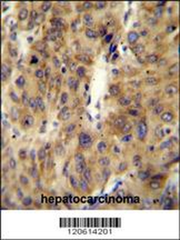 ACF Antibody (C-term)