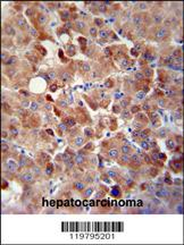 CHRDL1 Antibody (N-term)