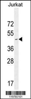 CD34 Antibody (Center)