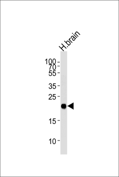 CPLX3 Antibody (Center)