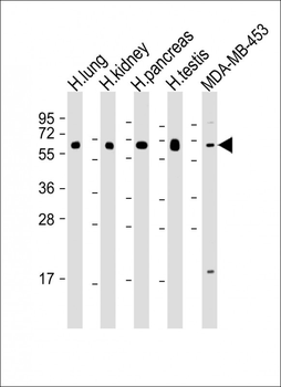 HHLA2 Antibody (N-term)