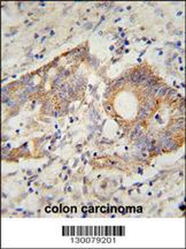 HHLA2 Antibody (N-term)