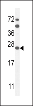 SCN1B Antibody (N-Term)