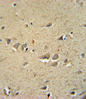 SCN1B Antibody (N-Term)