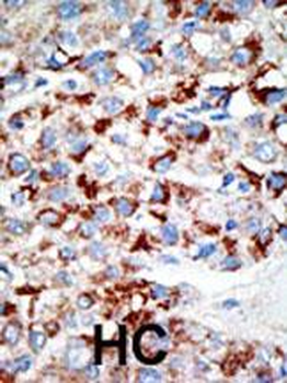 UBE1C Antibody (C-term)