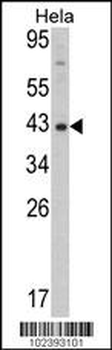 Mouse Dnmt3L Antibody