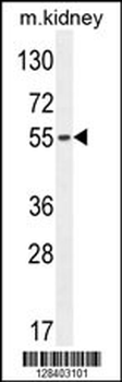 FBXO39 Antibody (C-term)