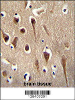 FBXO39 Antibody (C-term)