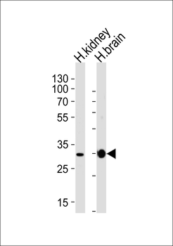 PRRG3 Antibody (Center)