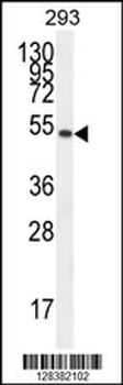 IGSF5 Antibody (N-term)