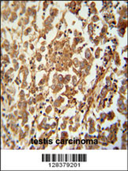 SPATC1 Antibody (N-term)