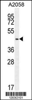 WDR21C Antibody (N-term)