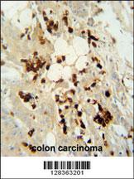 WDR21C Antibody (N-term)