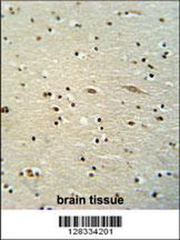 MAMSTR Antibody (N-term)