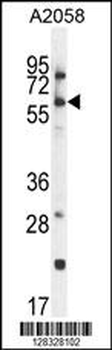 CCDC148 Antibody (Center)