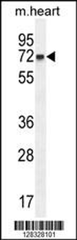 CCDC148 Antibody (Center)