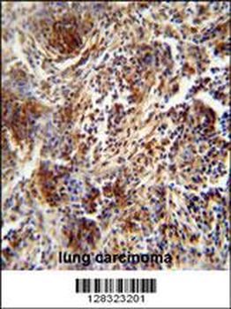 ZNF30 Antibody (N-term)