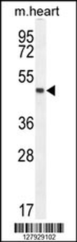 LRRC34 Antibody (Center)