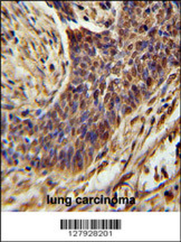 ZSWIM1 Antibody (C-term)