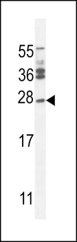 JOSD2 Antibody (N-term)