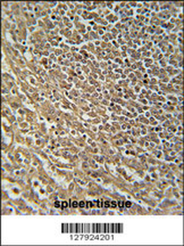 RASAL3 Antibody (C-term)