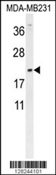 DMRTC1 Antibody (N-term)