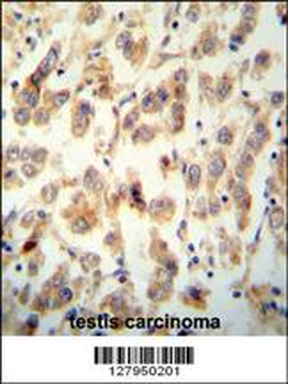 TTC16 Antibody (N-term)
