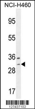WBSCR27 Antibody (N-term)