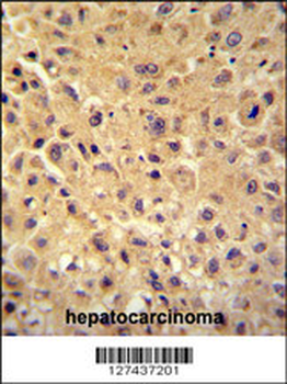 WBSCR27 Antibody (N-term)