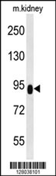 ZBTB41 Antibody (Center)