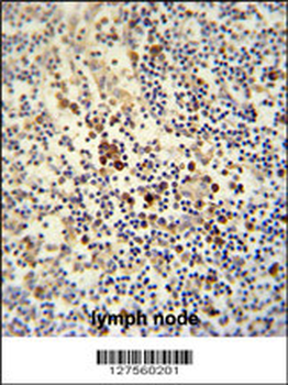 LY6G6C Antibody (C-term)