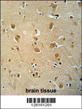 WWC3 Antibody (C-term)