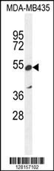 ZNF98 Antibody (C-term)