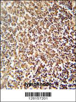 ZNF98 Antibody (C-term)