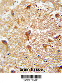 PIGX Antibody (N-term)